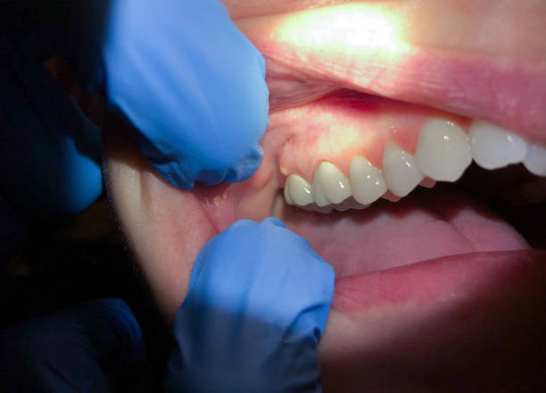 Best Urgent Care for Lost Fillings or Crowns in Grand Ledge, MI
